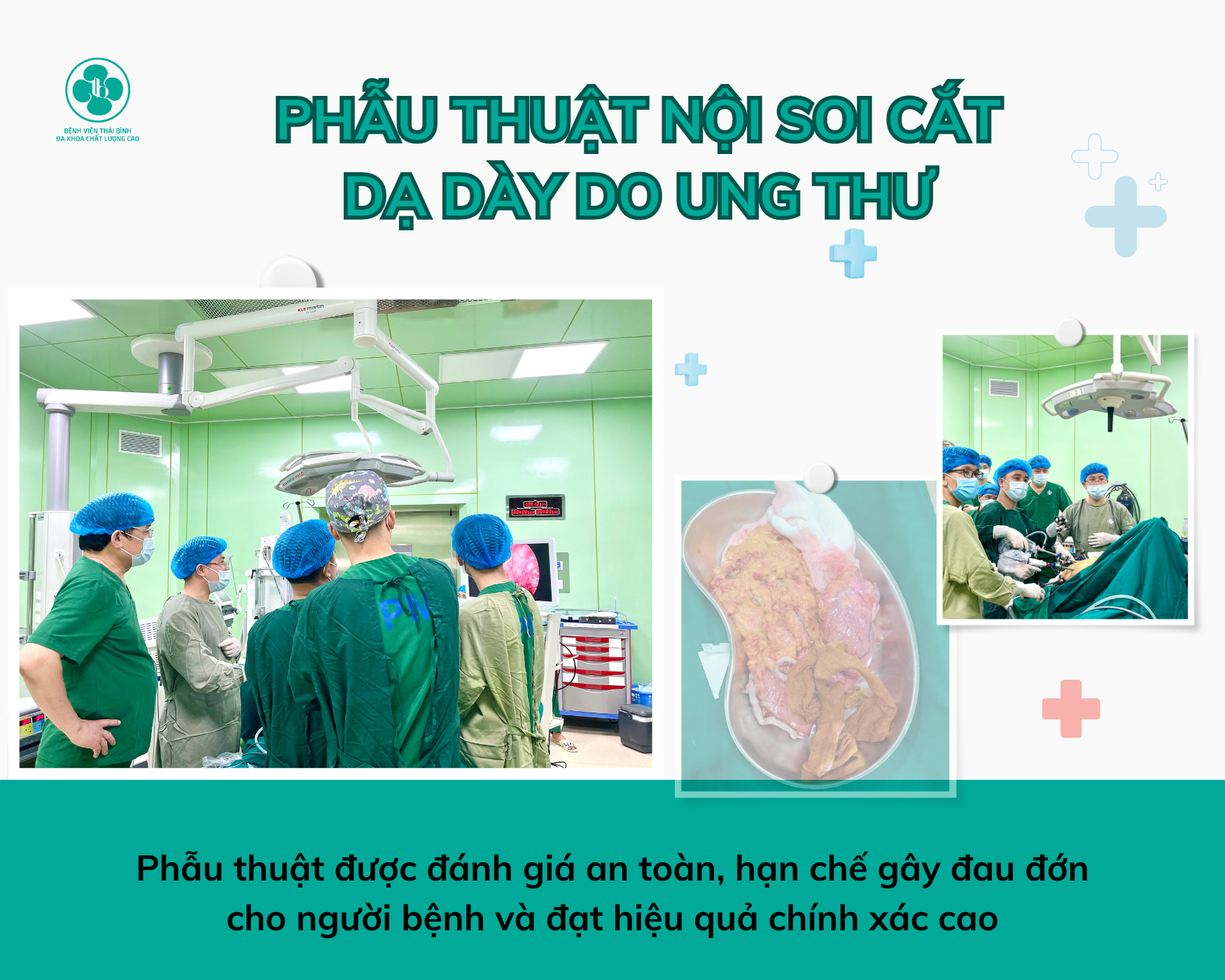 PHẪU THUẬT NỘI SOI CẮT DẠ DÀY DO UNG THƯ TẠI BỆNH VIỆN THÁI BÌNH