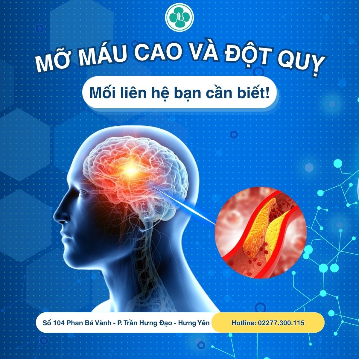 MỠ MÁU CAO VÀ ĐỘT QUỴ: MỐI LIÊN HỆ CẦN BIẾT