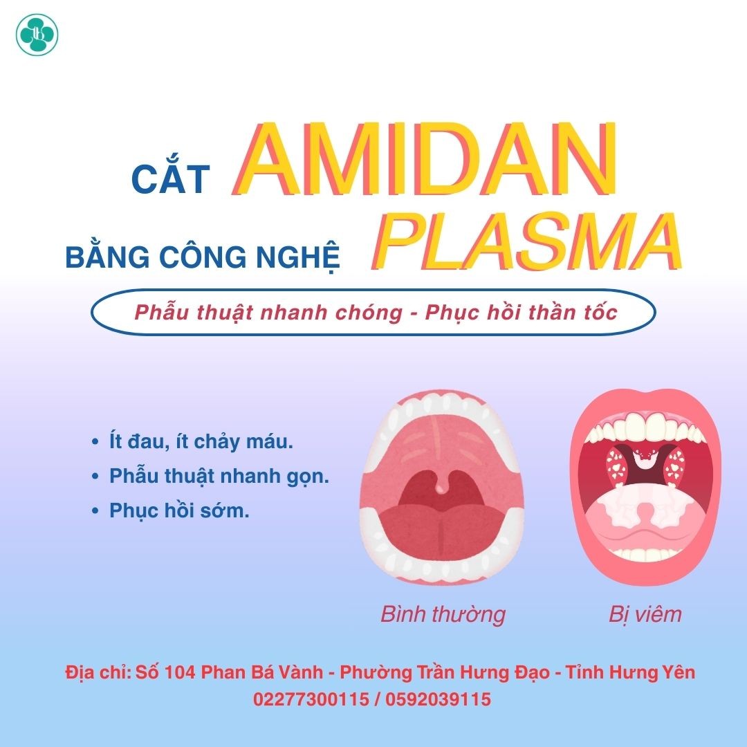 CẮT AMIDAN BẰNG DAO PLASMA – NHẸ NHÀNG, AN TOÀN, BHYT THÔNG TUYẾN HỖ TRỢ